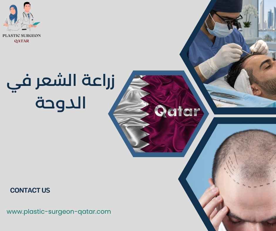 زراعة الشعر في الدوحة 