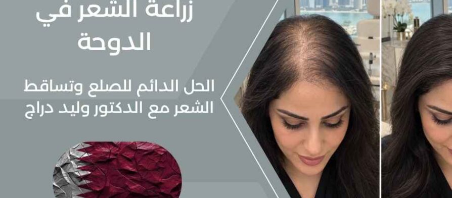 زراعة الشعر في الدوحة