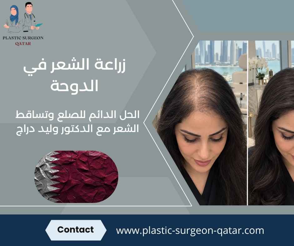 زراعة الشعر في الدوحة