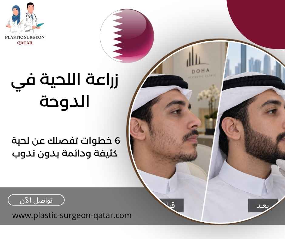 زراعة اللحية في الدوحة