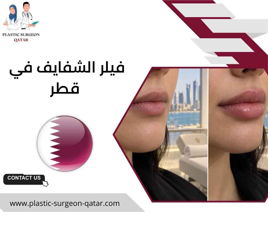 فيلر الشفايف في قطر فيلر الشفايف في قطر
