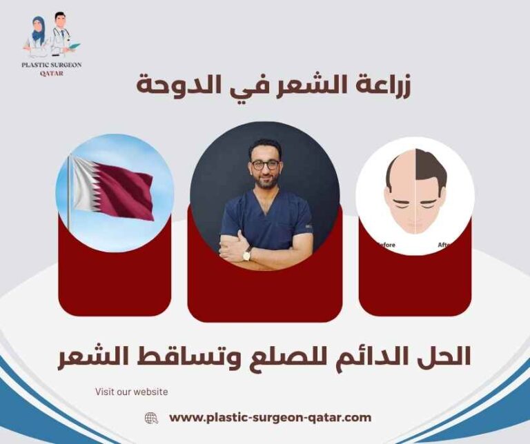 زراعة الشعر في الدوحة