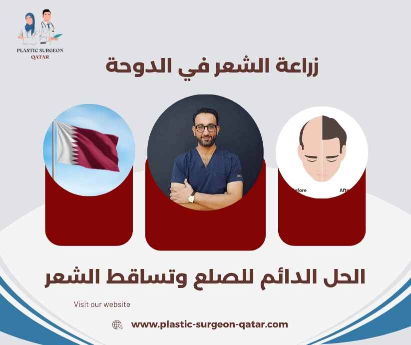 زراعة الشعر في الدوحة