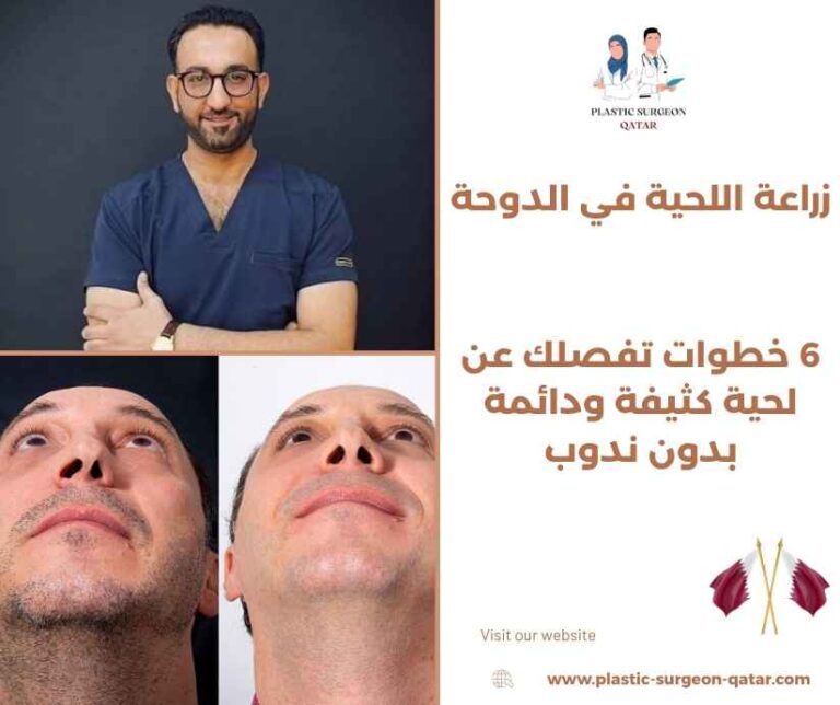 زراعة اللحية في الدوحة